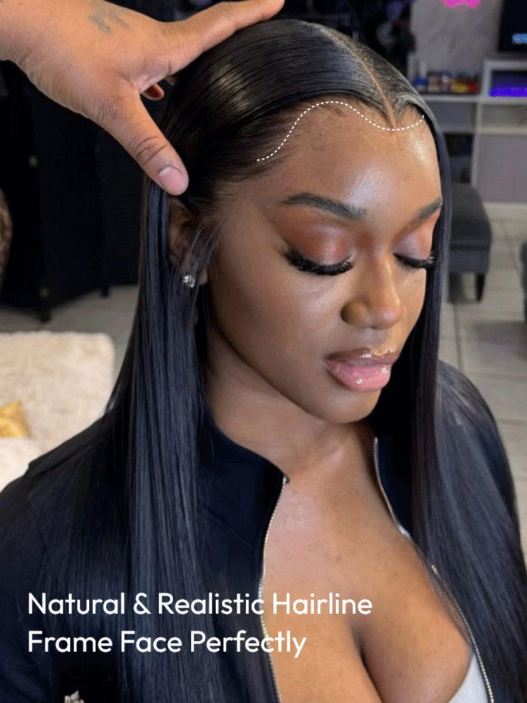 lagos hairline