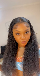 This unit is everything! The hairline is pre-
