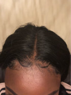 The hair came fast, when received the hair wa