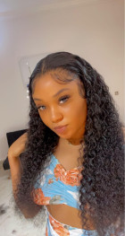 This unit is everything! The hairline is pre-