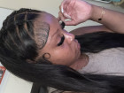 Hair fire
